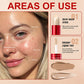 💄Dual-Ended Long-Lasting Lightweight Concealer-3